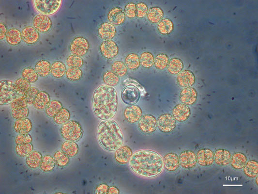 Kestvity Lugolin liuoksella