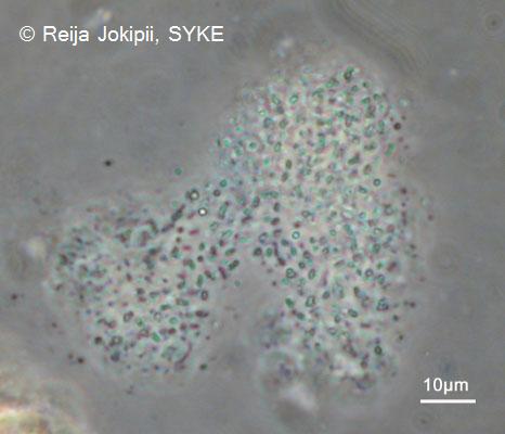 Kestvity Lugolin liuoksella