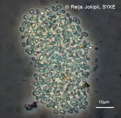 Kestvity Lugolin liuoksella