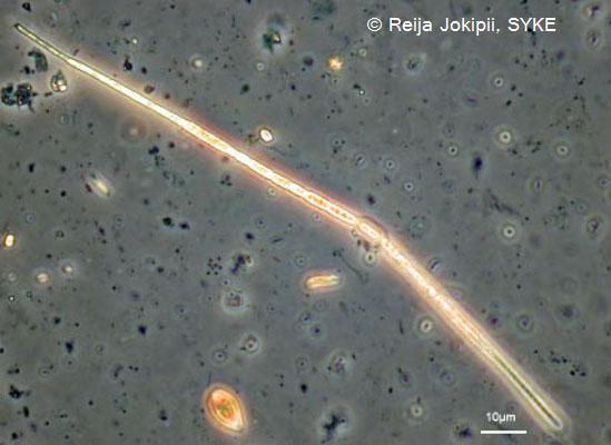 Rihma, Kestvity Lugolin liuoksella.