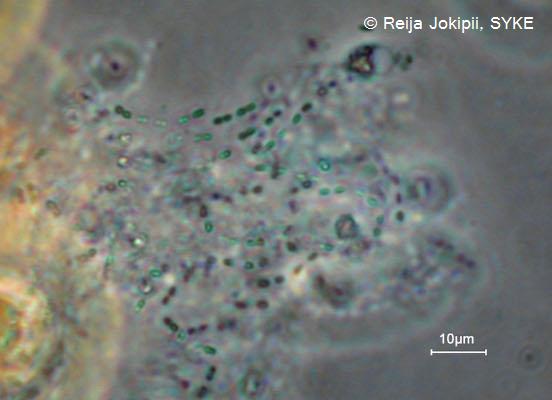 Kestvity Lugolin liuoksella