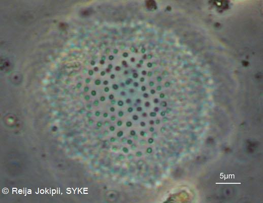 Kestvity Lugolin liuoksella