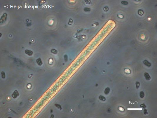 Kestvity Lugolin liuoksella