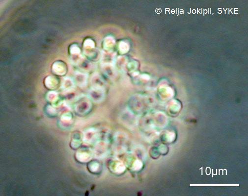 Kestvity Lugolin liuoksella
